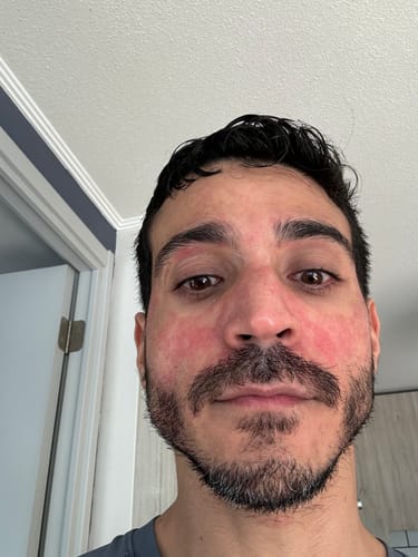 Customer photo review of Emulsión Recuperadora