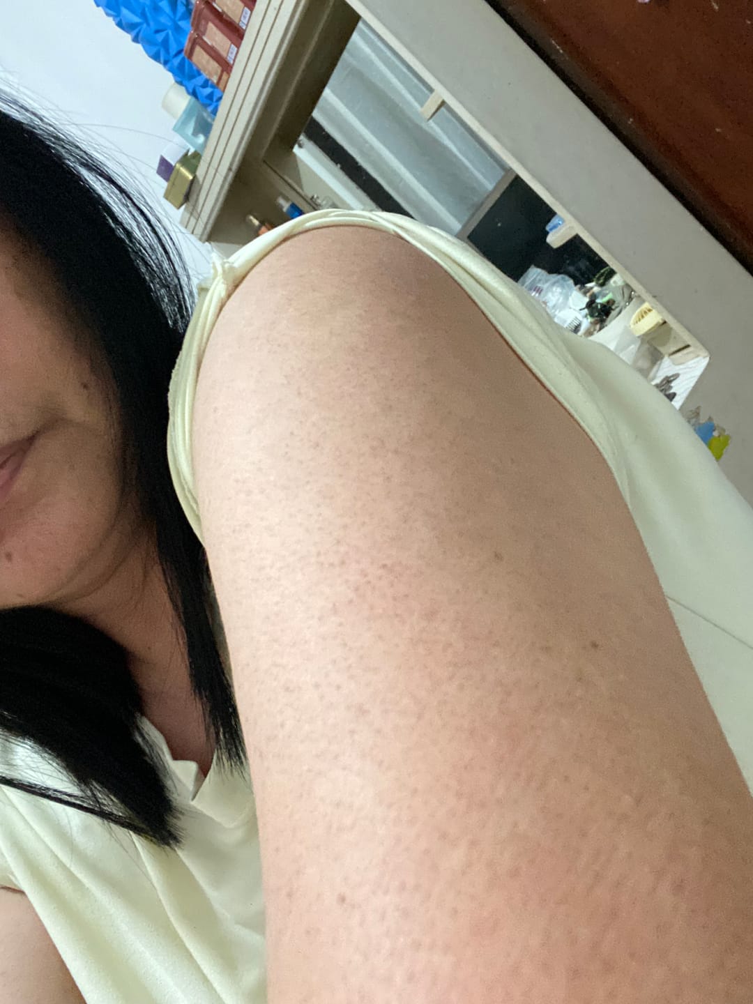 Customer photo review of Body Butter with Retinol & Niacinamide