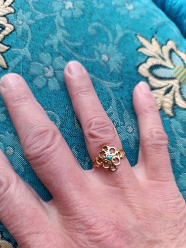 Customer photo review of טבעת היופי האינסופי - גלורי