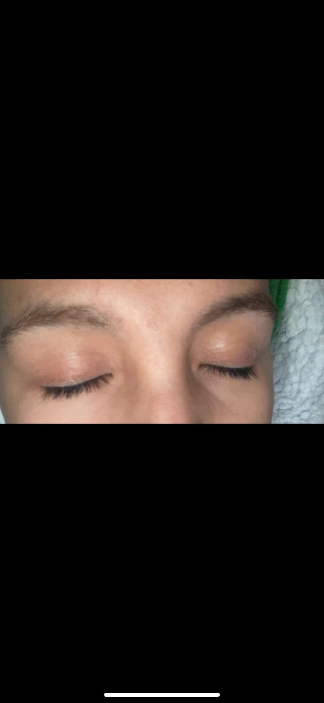 Customer photo review of SÉRUM AURA LASH
