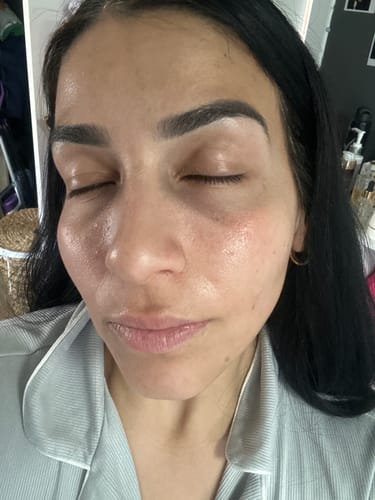 Customer photo review of Mikash trial size skincare set