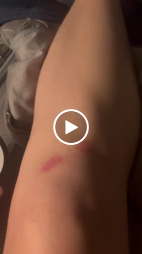Customer video review of Nectar Repair Balm