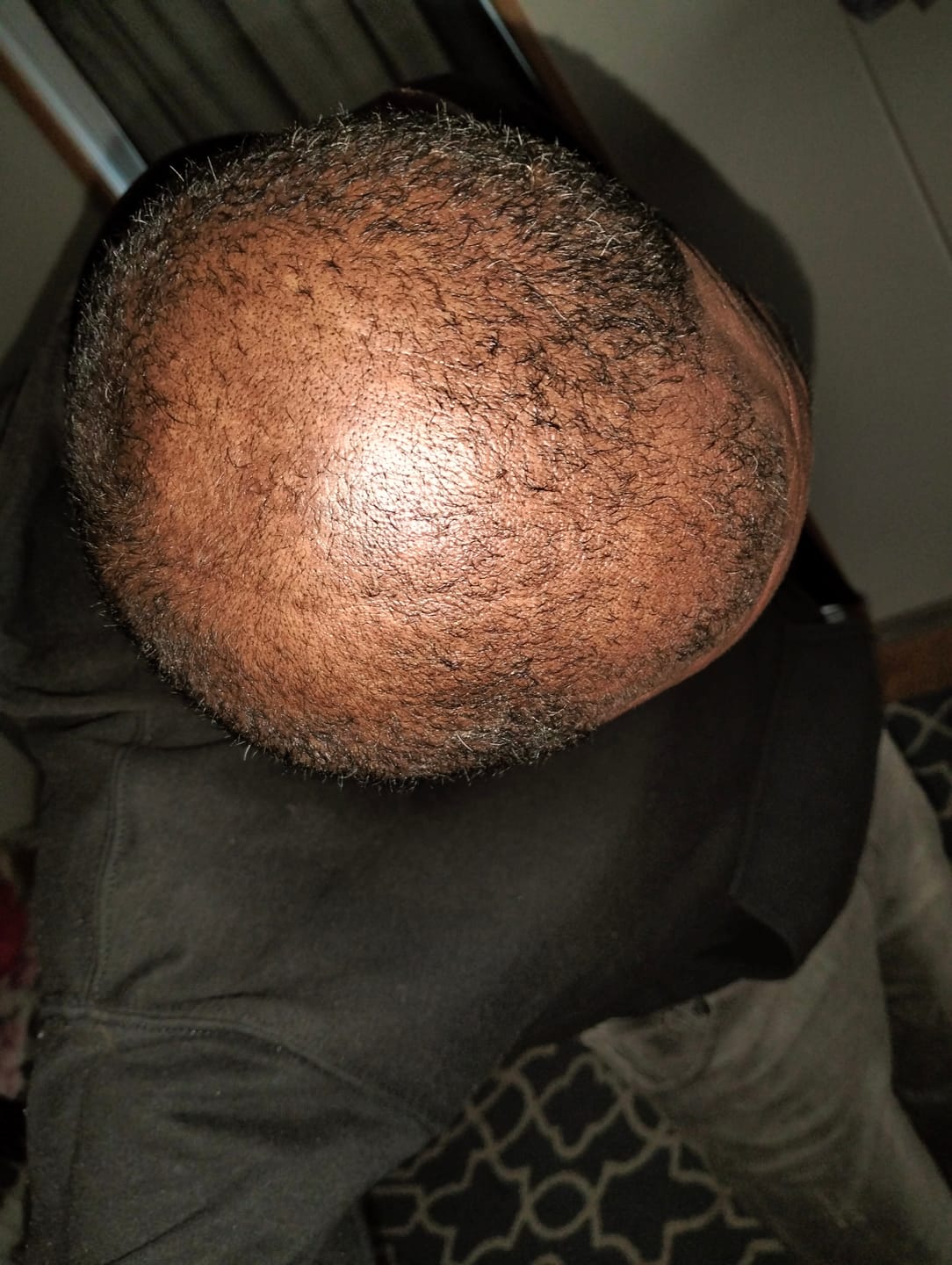 Customer photo review of Batana Oil for Hair