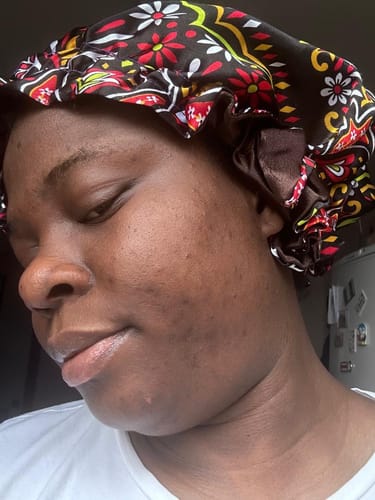 Customer photo review of Turmeric Glow Soap