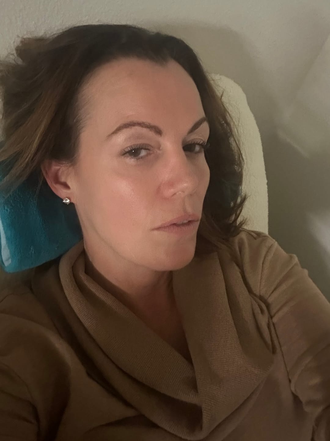 Customer photo review of Anti-Aging treatment