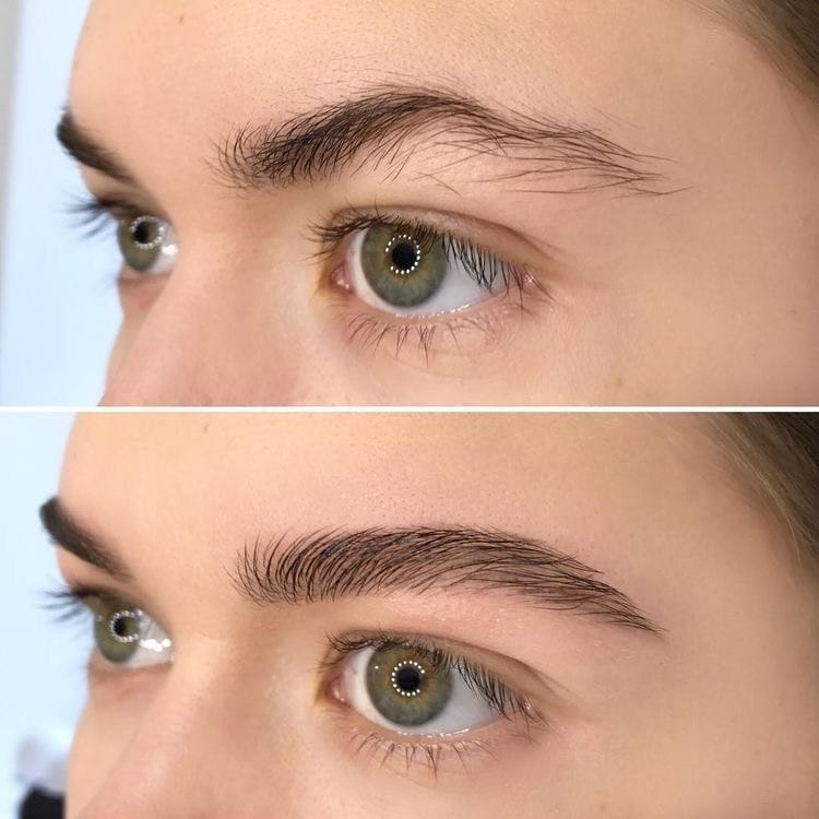 Customer photo review of IZABELL ROLLER - רולר לצמיחת הגבות מחדש