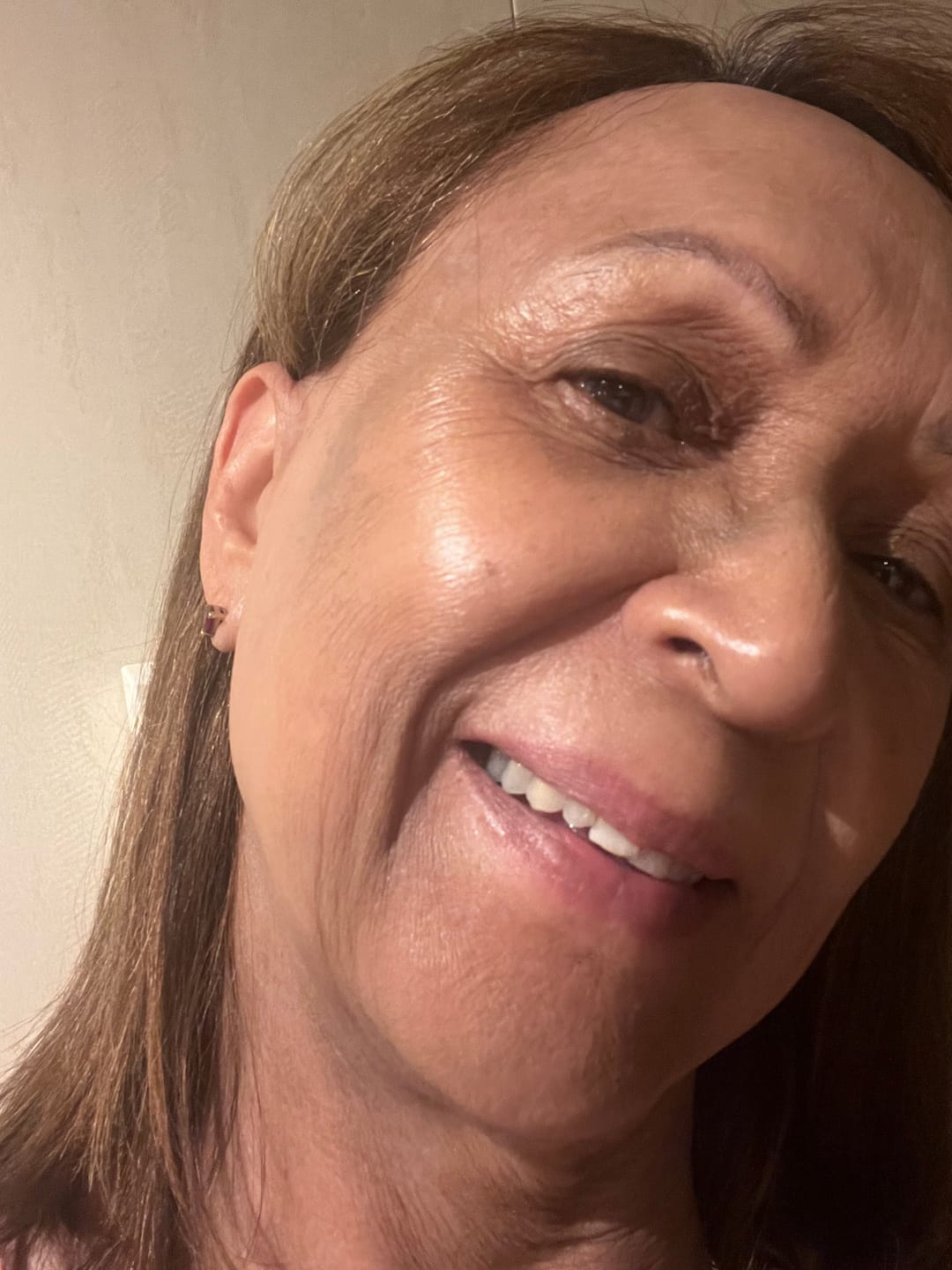 Customer photo review of dr.NC SKINCARE TOTAL TRANSFORMATION KIT