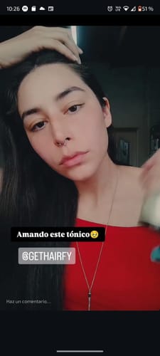 Customer photo review of Loción Anticaída