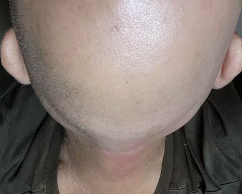 Customer photo review of Ubesværet hovedbarberingssæt