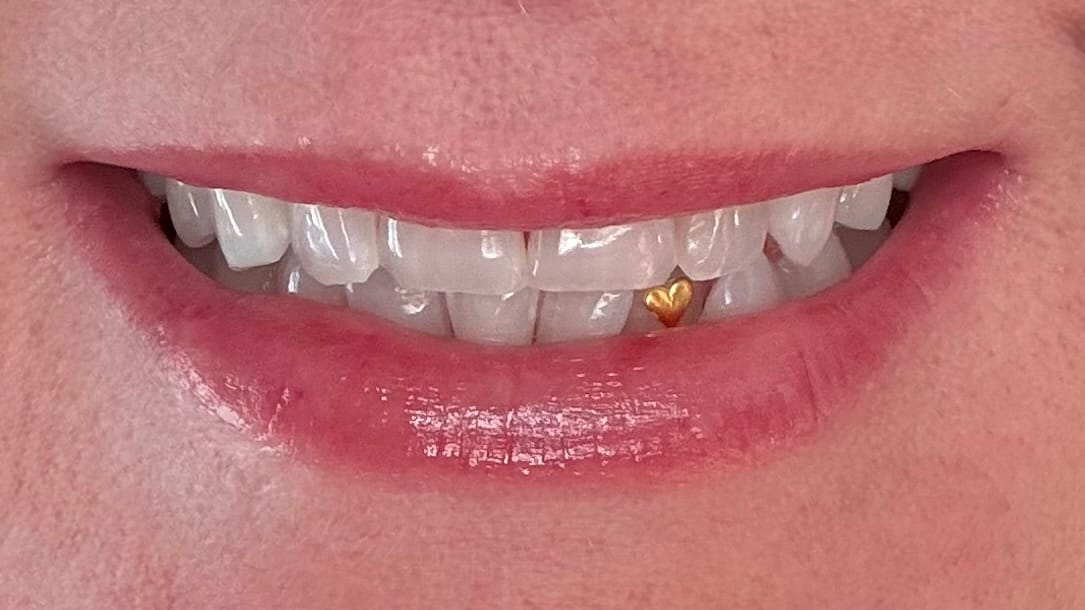 Customer photo review of Large Heart 24-karat gold