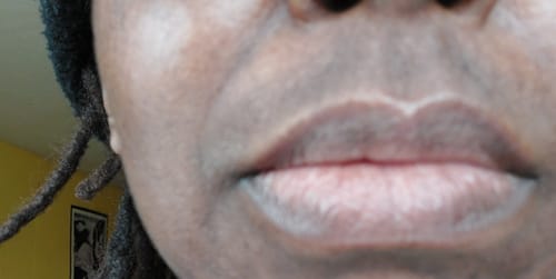 Customer photo review of Anti-Acne & Dark Spots African Soap