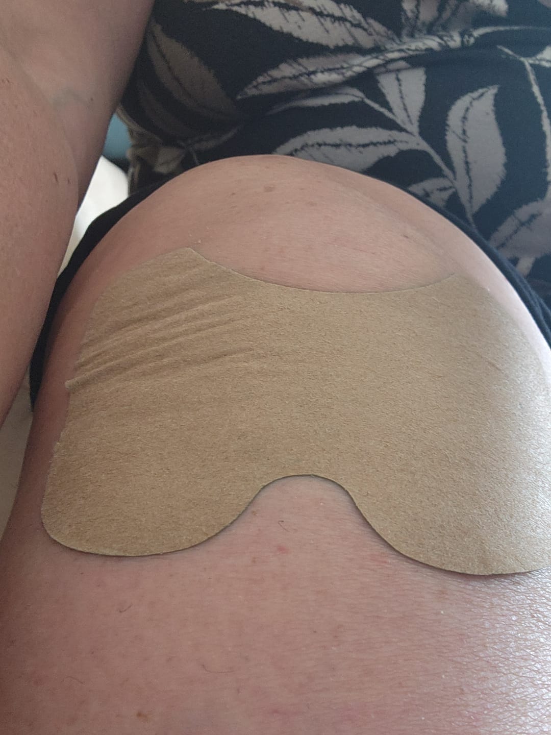 Customer photo review of Auxillium Knee Patch (fka Heaven Patch)