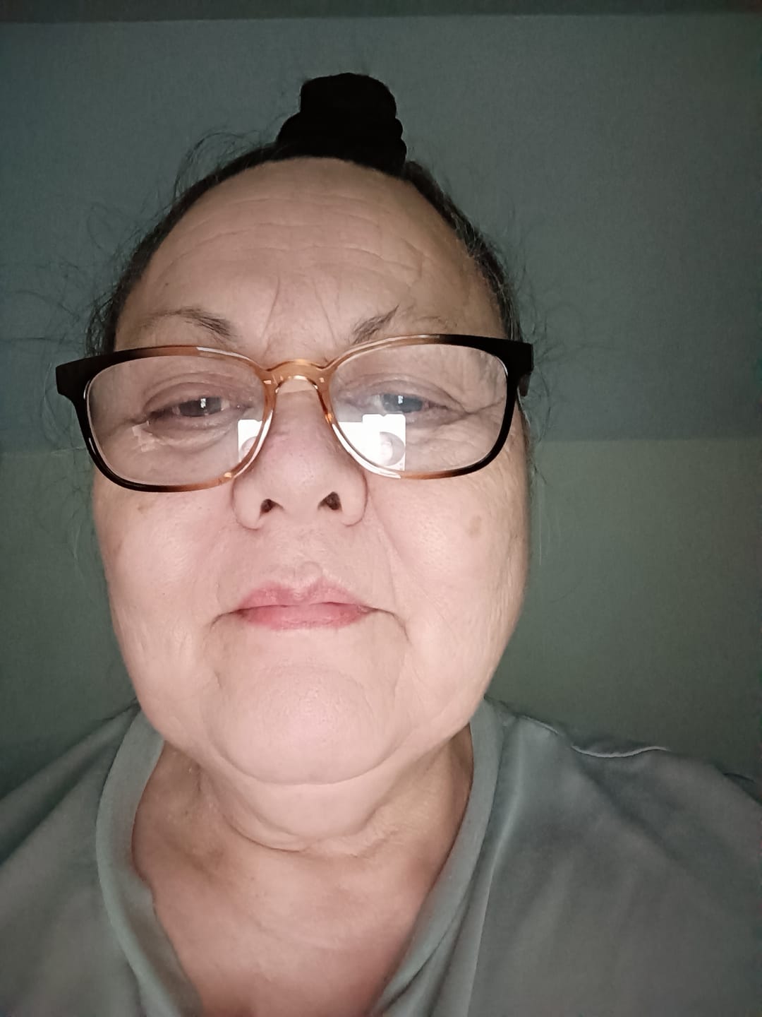 Customer photo review of Kawakawa Repair Balm - Winner, Best SOS/Healing Balm 2024