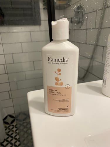 Customer photo review of שמפו טיפולי נגד קשקשים | SCALP CONTROL
