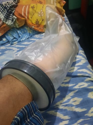 Customer photo review of Cast Cover - Leg | Cast Cover for Left & Right Leg (1 Piece) | Protects Bandage From Water Exposure during Bath & Shower (Grey)