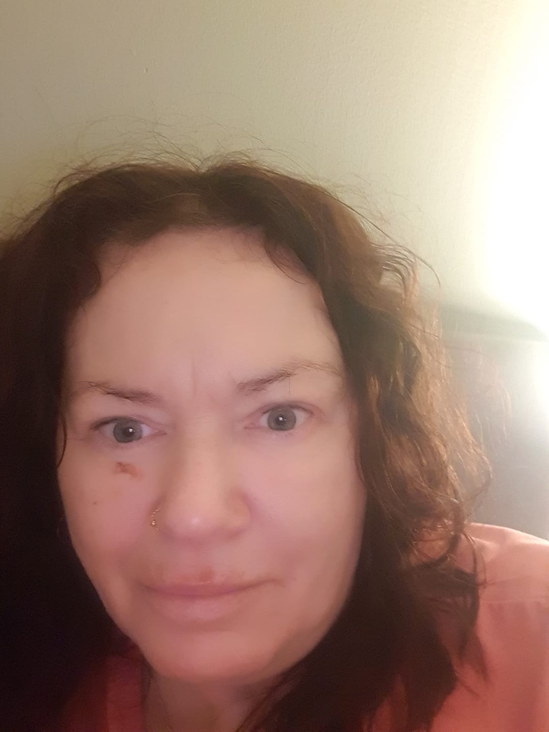 Customer photo review of Anti-Aging treatment