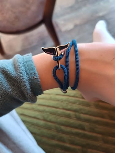 Customer photo review of Whale Tracking Bracelet