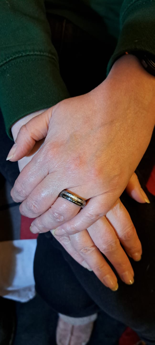 Customer photo review of The Steely Blue 6mm Wonder Ring