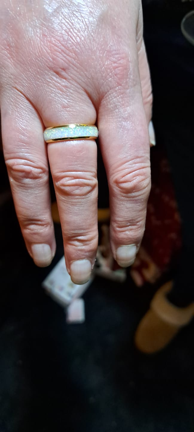 Customer photo review of The Golden White Opal 6mm Wonder Ring