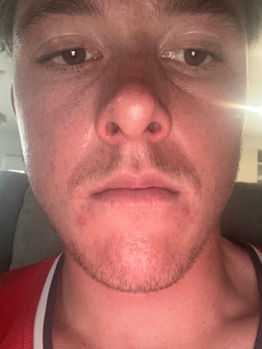 Customer photo review of Skin & Gut Maintain™