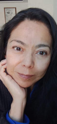 Customer photo review of Serum Vitamina C + Ácido Hialurónico + Vitamina E - 95% Ingredientes Naturales - Para Todo Tipo de Piel - 30ml