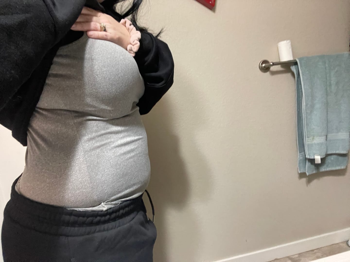 Customer photo review of MB V Waist Trainer