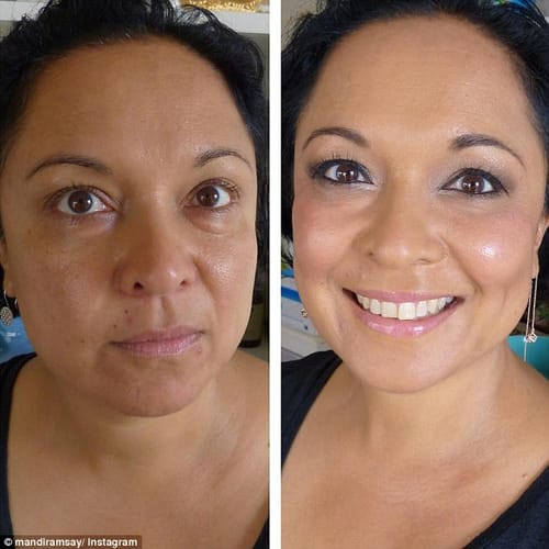 Customer photo review of Nomend AI-SkinRevive Kit