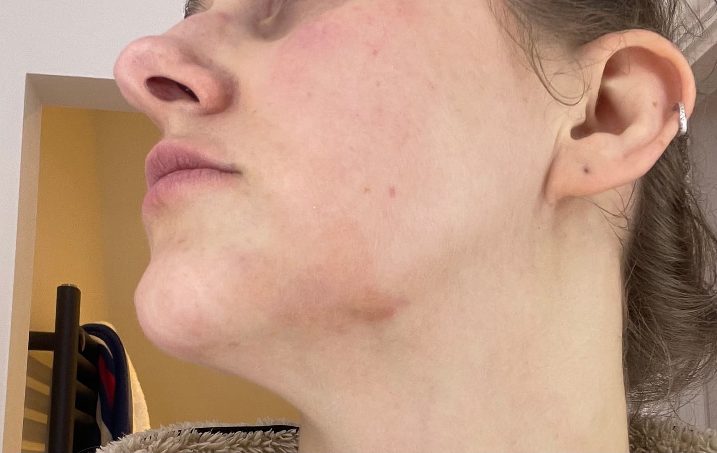 Customer photo review of Bioskin Duo Pack