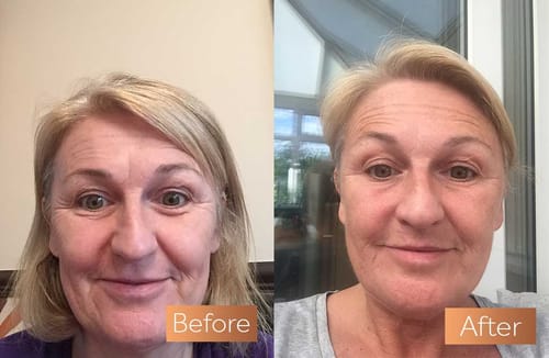 Customer photo review of Nomend AI-SkinRevive Kit