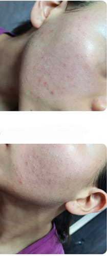 Customer photo review of Formula Personalizada Rx