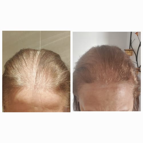 Customer photo review of 55% OFF Black Friday Bundle