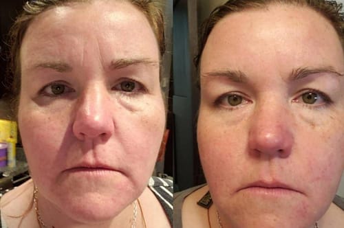 Customer photo review of Nomend AI-SkinRevive Kit