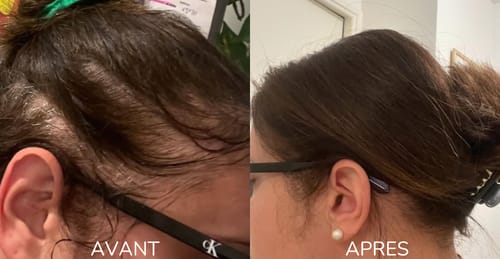 Customer photo review of Shampoing Solide Gingembre Anti chute & Pousse de cheveux - ECLAMA