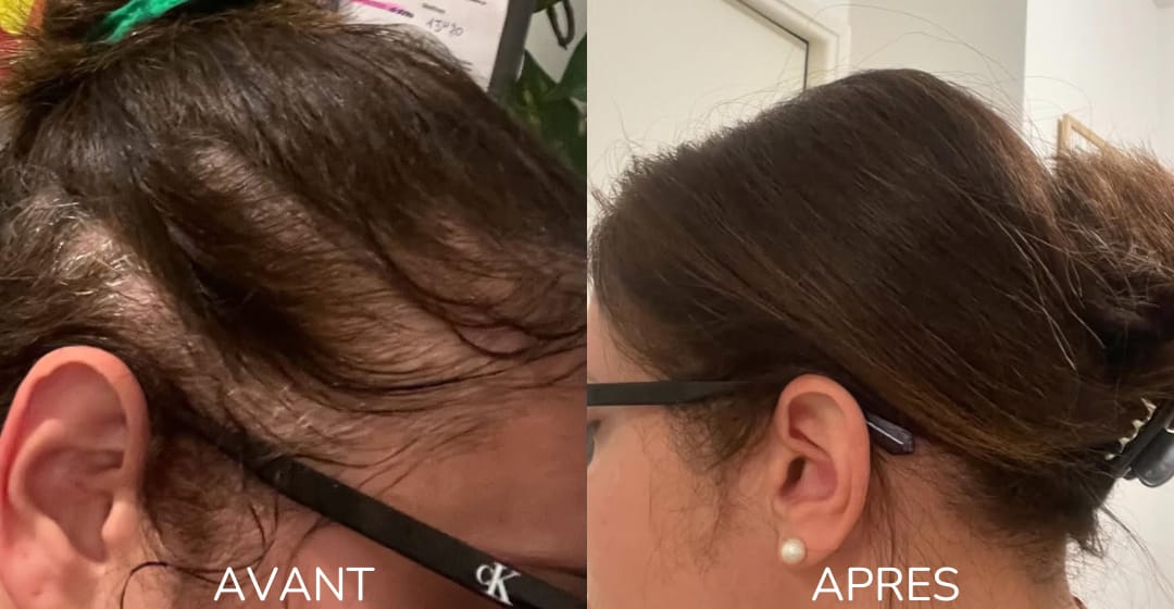Customer photo review of Shampoing Solide Gingembre Anti chute & Pousse de cheveux - ECLAMA
