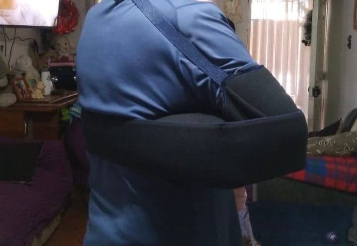 Customer photo review of Abductor de Hombro