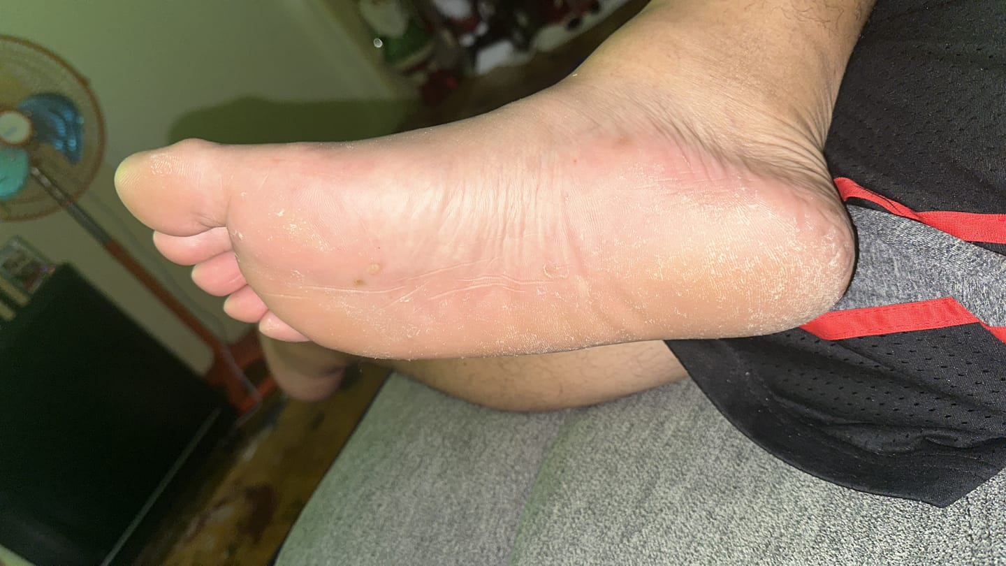 Customer photo review of Foot Balm