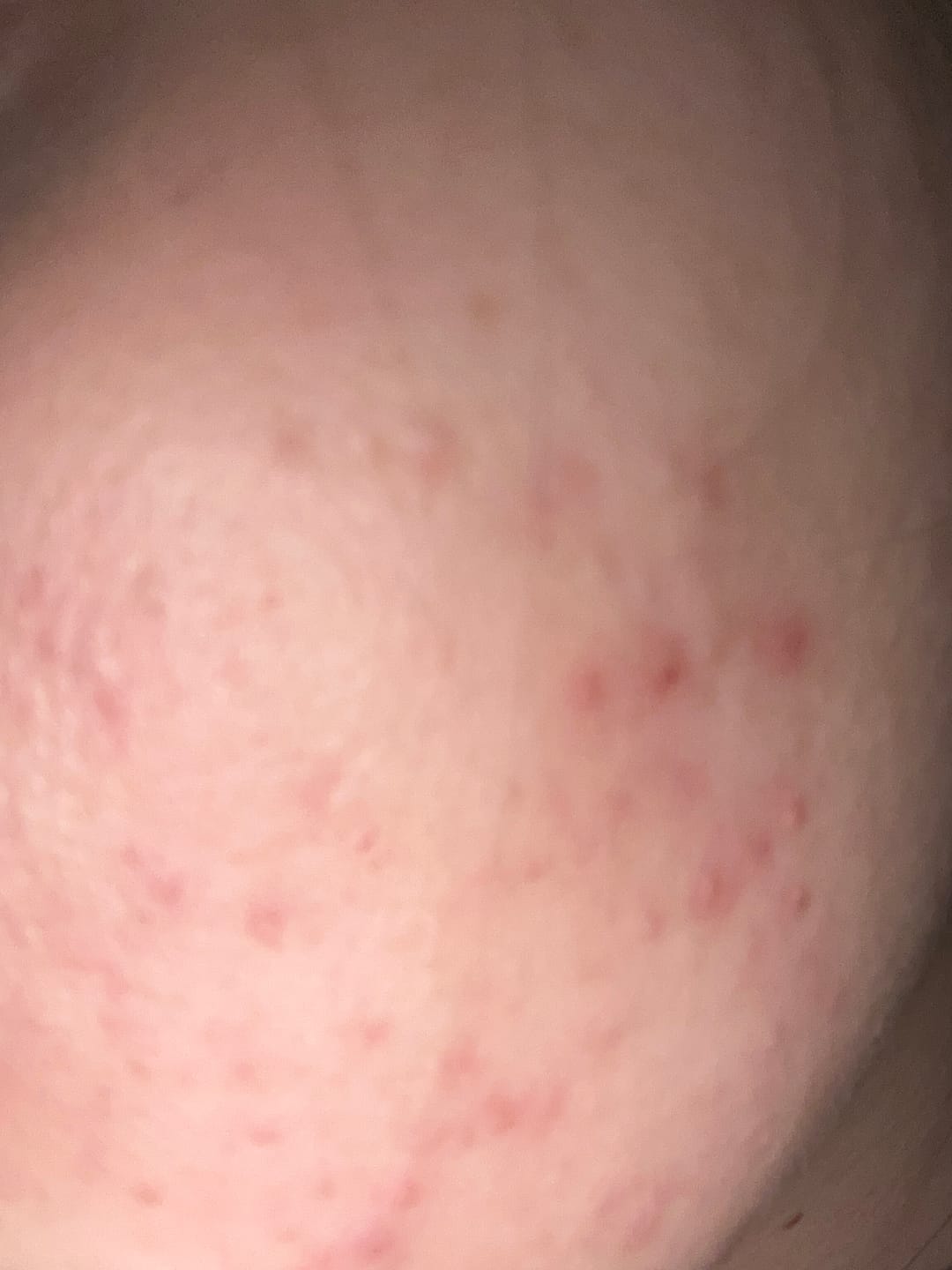 Customer photo review of [W]ASH AWAY - Purifying Gel Cleanser