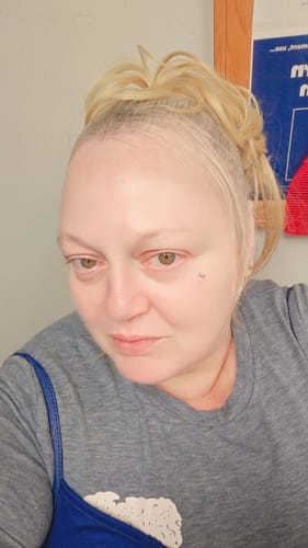 Customer photo review of Nomend AI-SkinRevive Kit