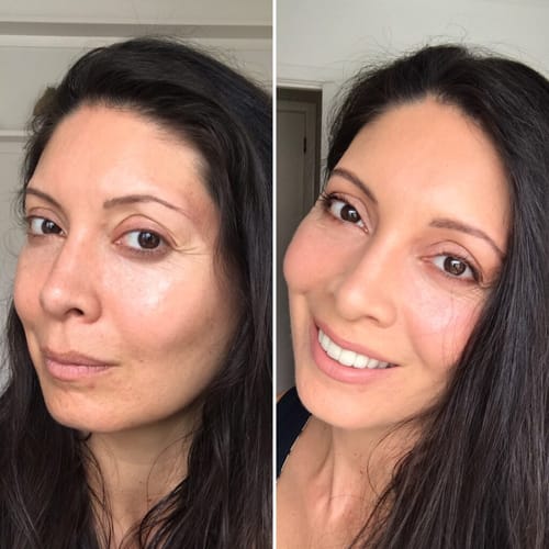 Customer photo review of Nomend AI-SkinRevive Kit