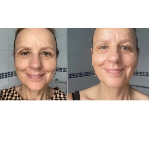 Customer photo review of Vitamin C Serum + Sculpting Serum