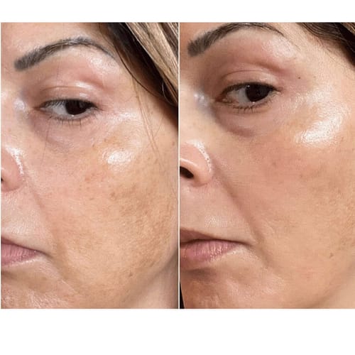 Customer photo review of Vitamin C Serum + Sculpting Serum