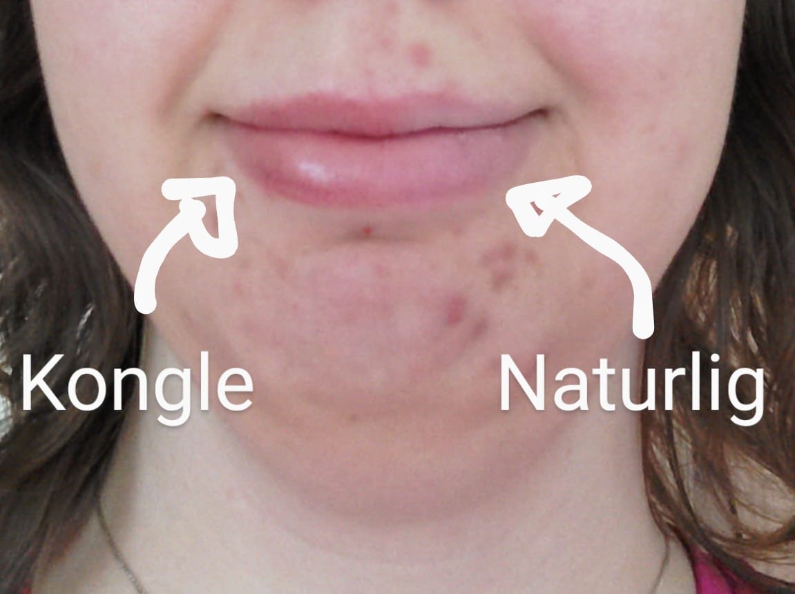 Customer photo review of Konglelepper