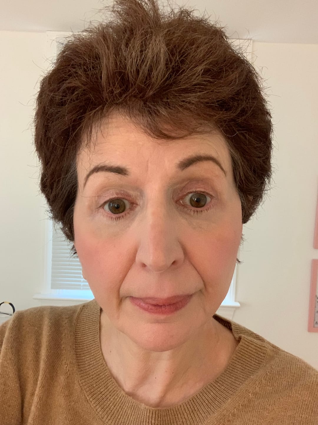Customer photo review of Eye Cream with Superfruits