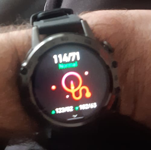 Customer photo review of HYPER SMARTWATCH PRO®