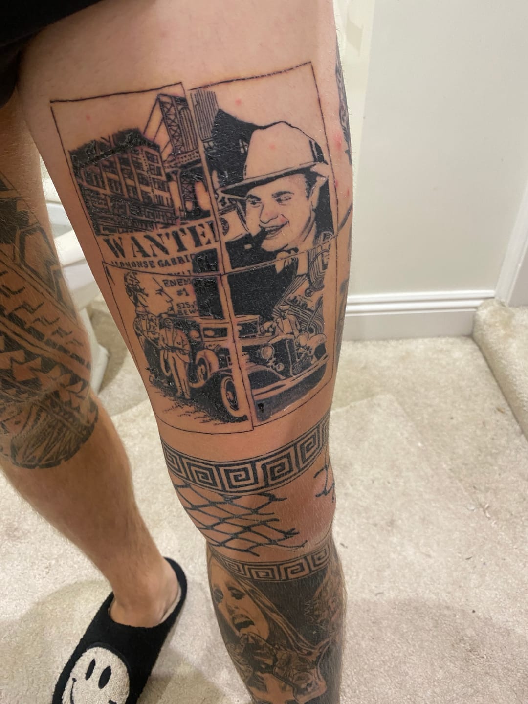 Customer photo review of TattooNumbx Tattoo Bundle