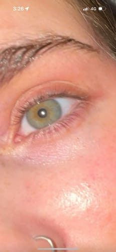 Customer photo review of iGlow Lash Maximizer - Lash Serum, 3 ml