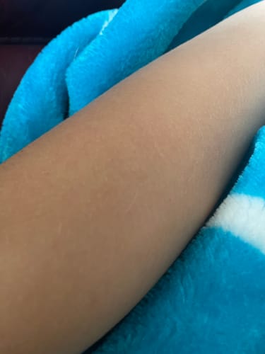 Customer photo review of Hydration Era Body Lotion