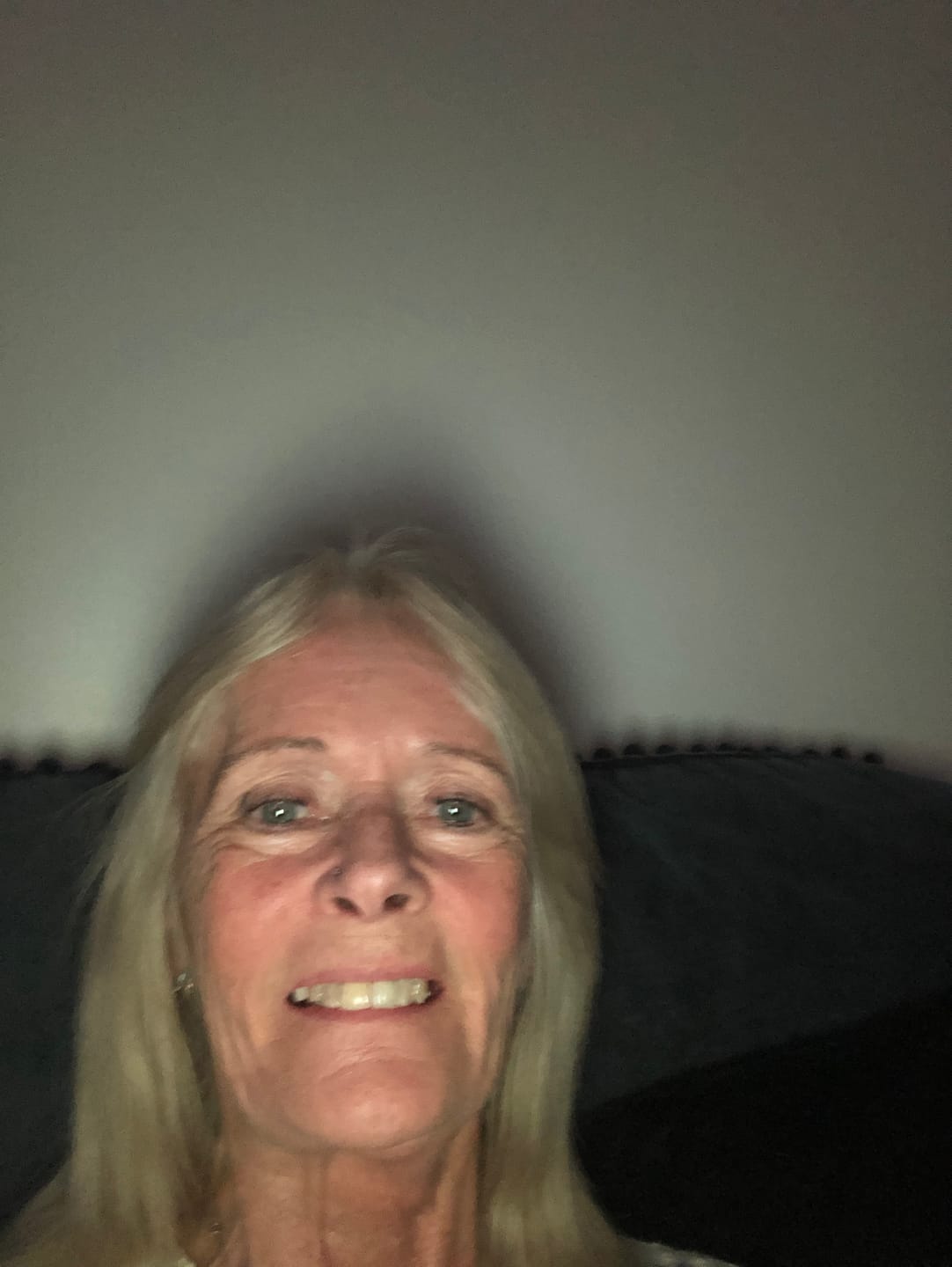 Customer photo review of Anti-Aging treatment