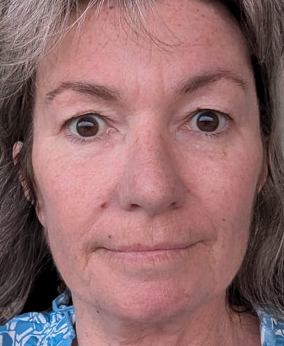 Customer photo review of Sea Cucumber Collagen Day & Night Pack