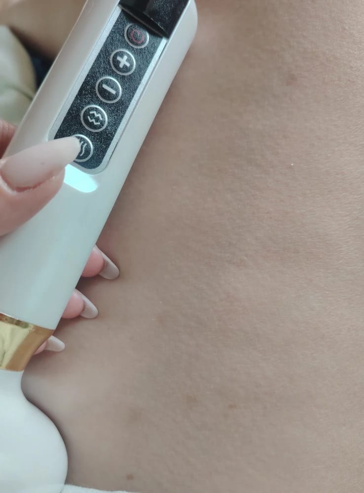 Customer photo review of GlowNow Cellulite-Massagegerät